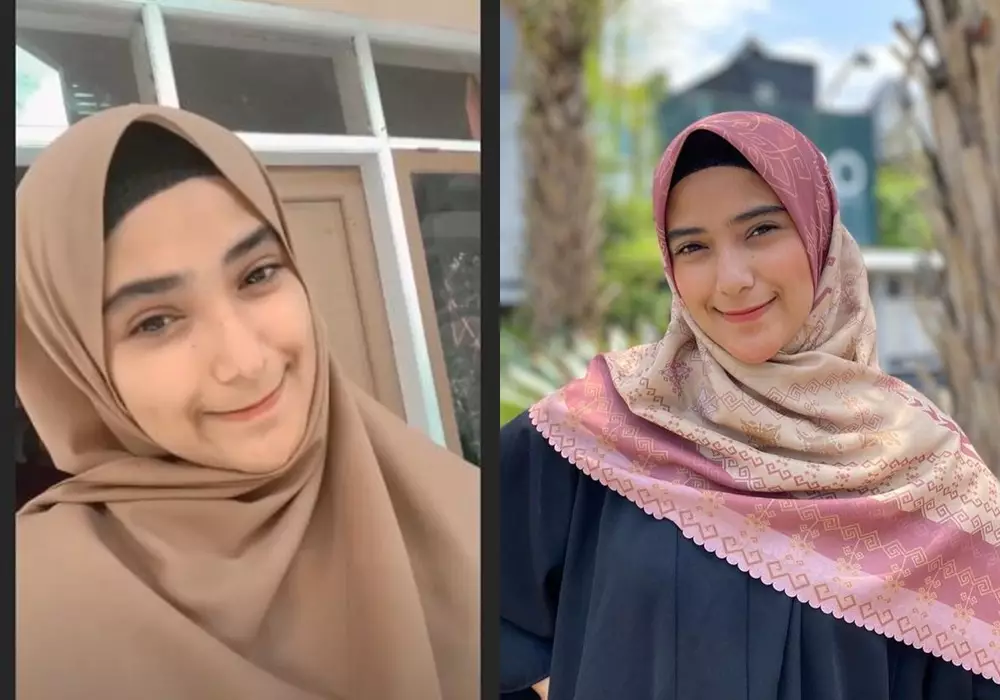 Beda penampilan sebelum dan sesudah terkenal © Instagram 