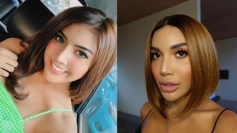 millen cyrus filler bibir Instagram