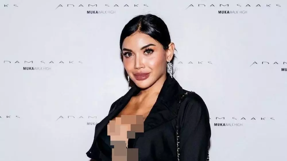 millen cyrus filler bibir Instagram