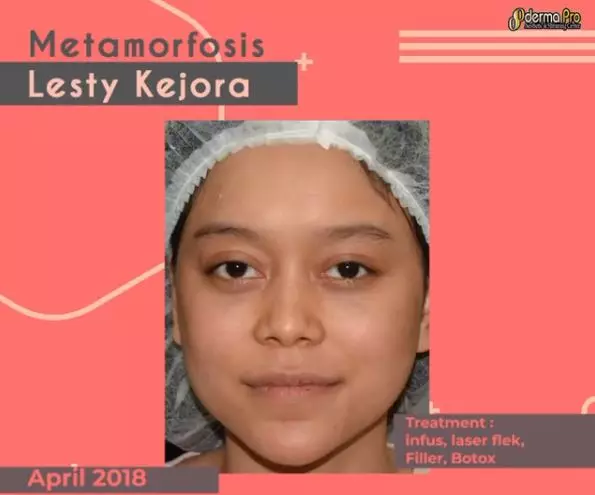 lesty lakukan perawatan Instagram lesty lakukan perawatan Instagram