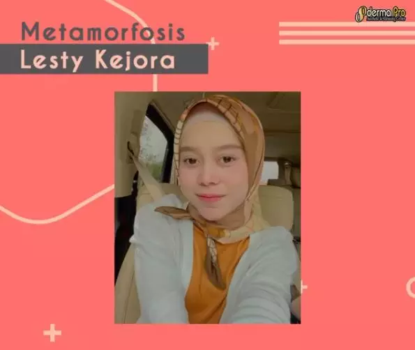 lesty lakukan perawatan Instagram lesty lakukan perawatan Instagram