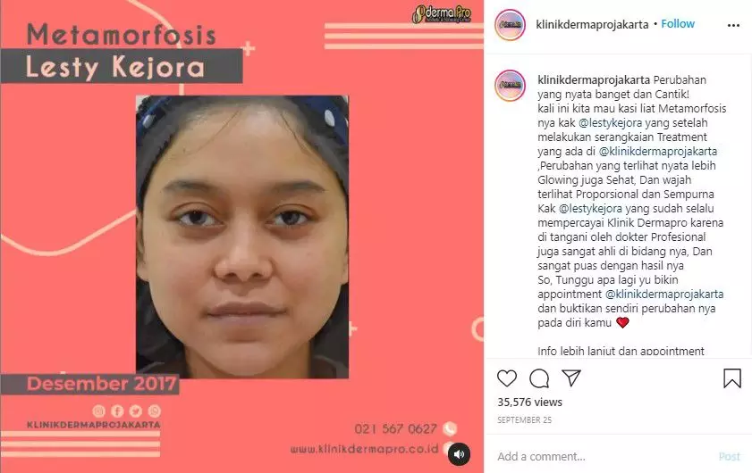 lesty lakukan perawatan Instagram lesty lakukan perawatan Instagram