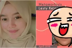 Potret perbedaan wajah Lesty Kejora sebelum & usai botox dan filler