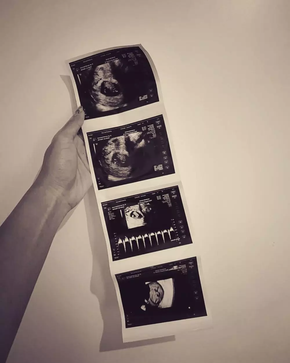 Audy Marissa hamil Instagram