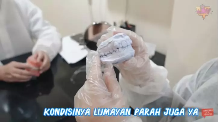 Irish Bella pakai behel © YouTube Irish Bella pakai behel © YouTube