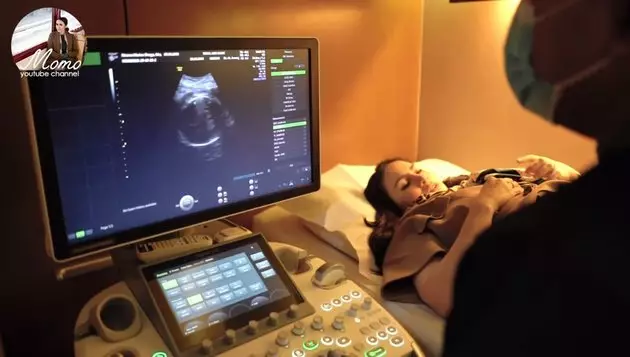 Momo USG kehamilan kedua © 2020 brilio.net YouTube
