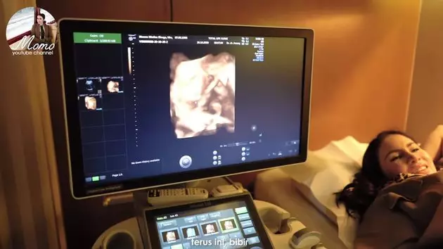 Momo USG kehamilan kedua © 2020 brilio.net YouTube