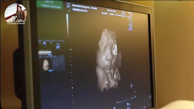 Momo USG kehamilan kedua © 2020 brilio.net YouTube