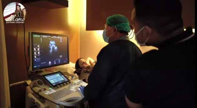 Momo USG kehamilan kedua © 2020 brilio.net YouTube