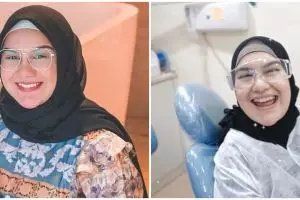 Pakai behel demi hilangkan gingsul, ini 5 potret terbaru Irish Bella