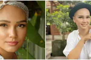 Berhasil sembuh kanker ovarium, Feby Febiola tulis caption menyentuh