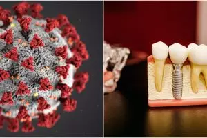 Cara kreatif perajin gigi palsu bertahan kala pandemi