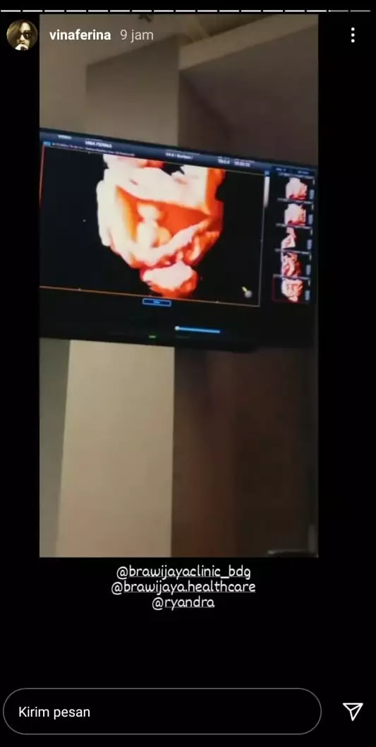 Vina Ferina cek kehamilan © Instagram Vina Ferina cek kehamilan © Instagram