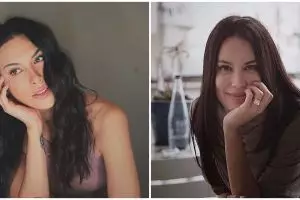 Viral hasil rontgen Sophia Latjuba, dinilai cantik sampai ke tengkorak