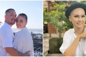 5 Fakta Feby Febiola sembuh dari kanker, jalani 6 kali kemoterapi