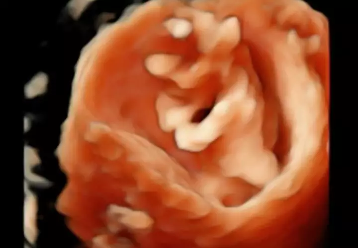 Momen pemeriksaan kandungan Audi Marissa  © Instagram Momen pemeriksaan kandungan Audi Marissa  © Instagram