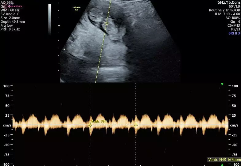 Momen pemeriksaan kandungan Audi Marissa  © Instagram Momen pemeriksaan kandungan Audi Marissa  © Instagram