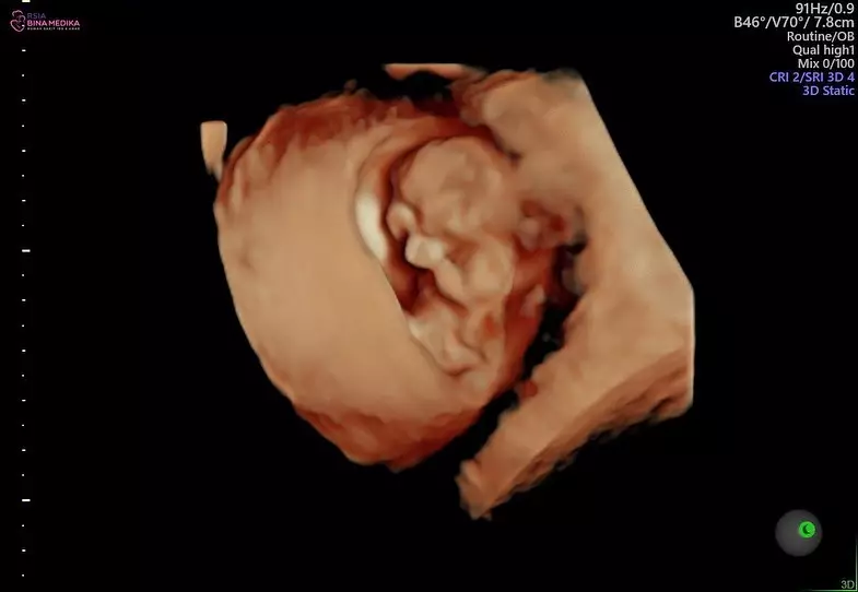 Momen pemeriksaan kandungan Audi Marissa  © Instagram Momen pemeriksaan kandungan Audi Marissa  © Instagram