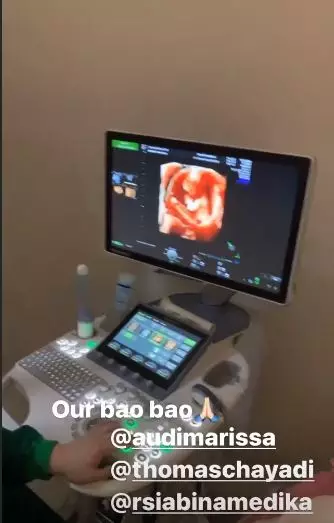 Momen pemeriksaan kandungan Audi Marissa  © Instagram Momen pemeriksaan kandungan Audi Marissa  © Instagram