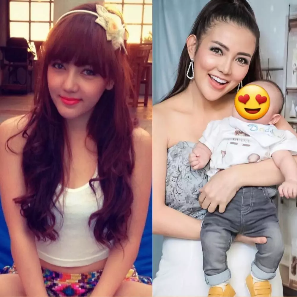 Potret seleb sesudah dan sebelum operasi plastik © 2020 brilio.net