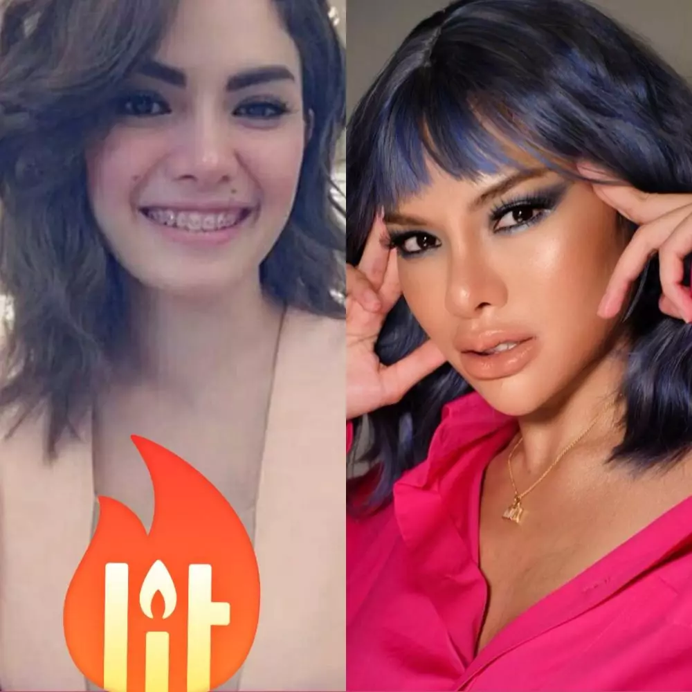 Potret seleb sesudah dan sebelum operasi plastik © 2020 brilio.net