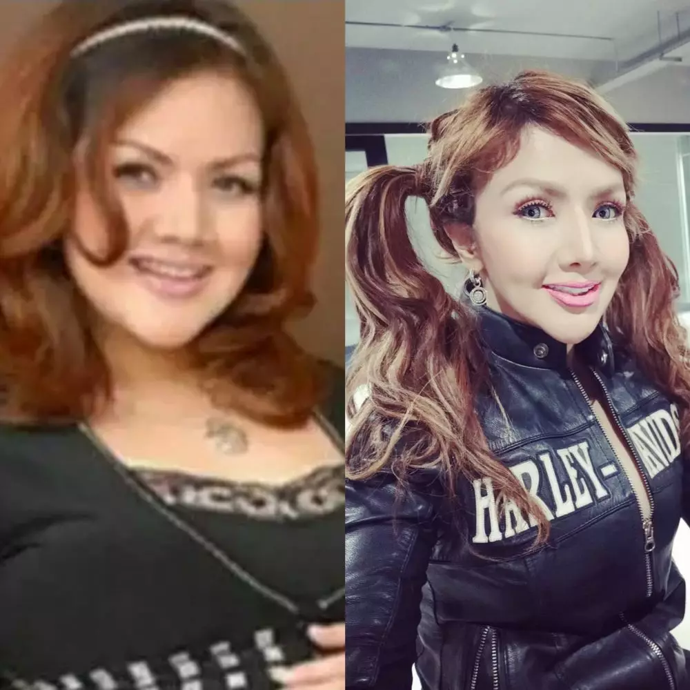 Potret seleb sesudah dan sebelum operasi plastik © 2020 brilio.net