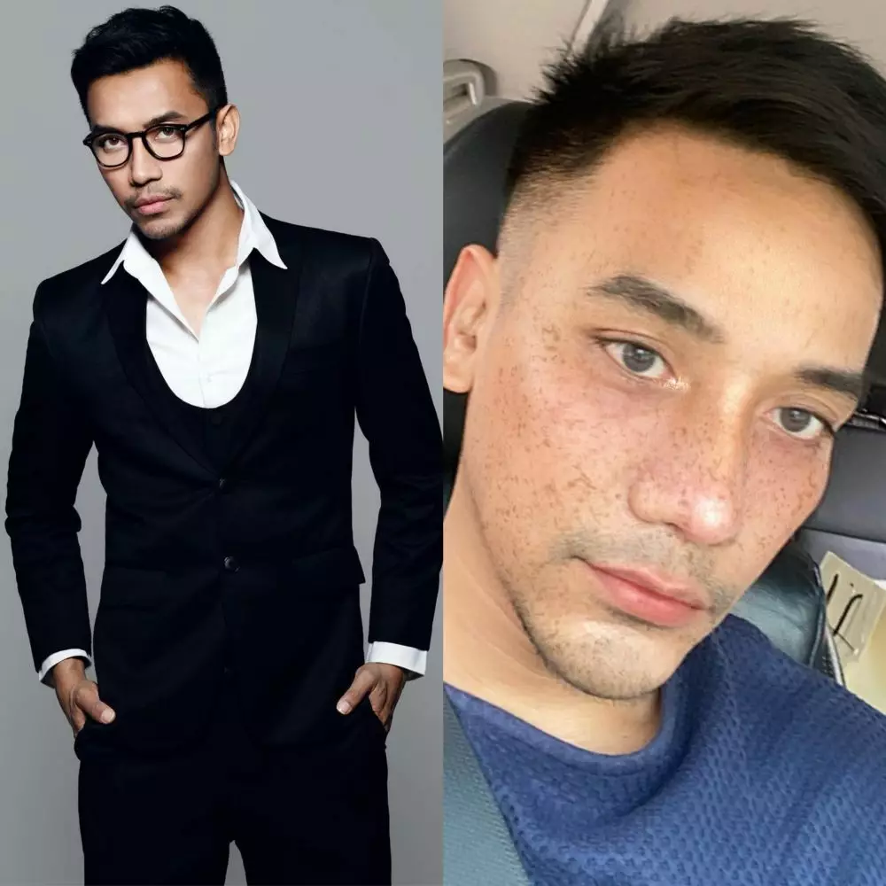 Potret seleb sesudah dan sebelum operasi plastik © 2020 brilio.net