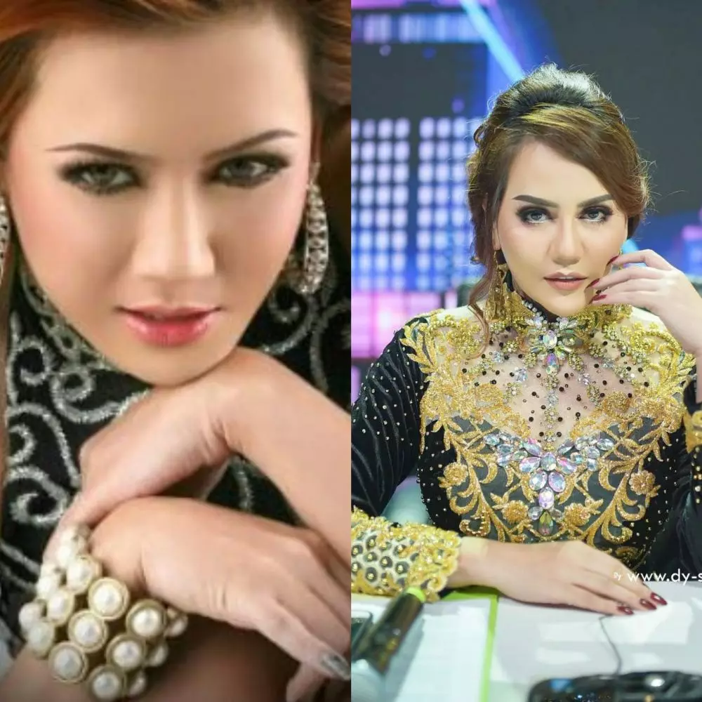 Potret seleb sesudah dan sebelum operasi plastik © 2020 brilio.net