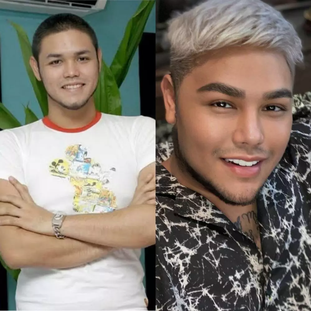 Potret seleb sesudah dan sebelum operasi plastik © 2020 brilio.net