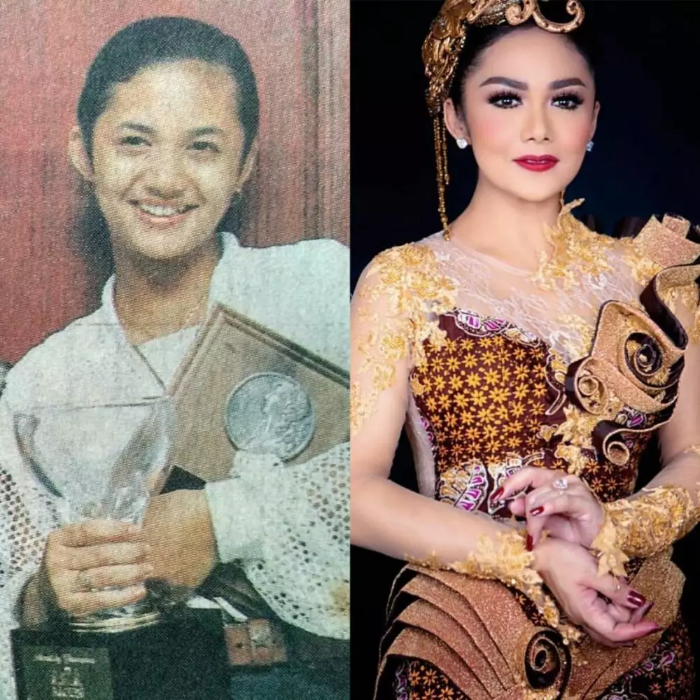 Potret seleb sesudah dan sebelum operasi plastik © 2020 brilio.net