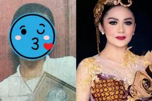 Potret 7 seleb sebelum dan sesudah operasi plastik, bikin pangling