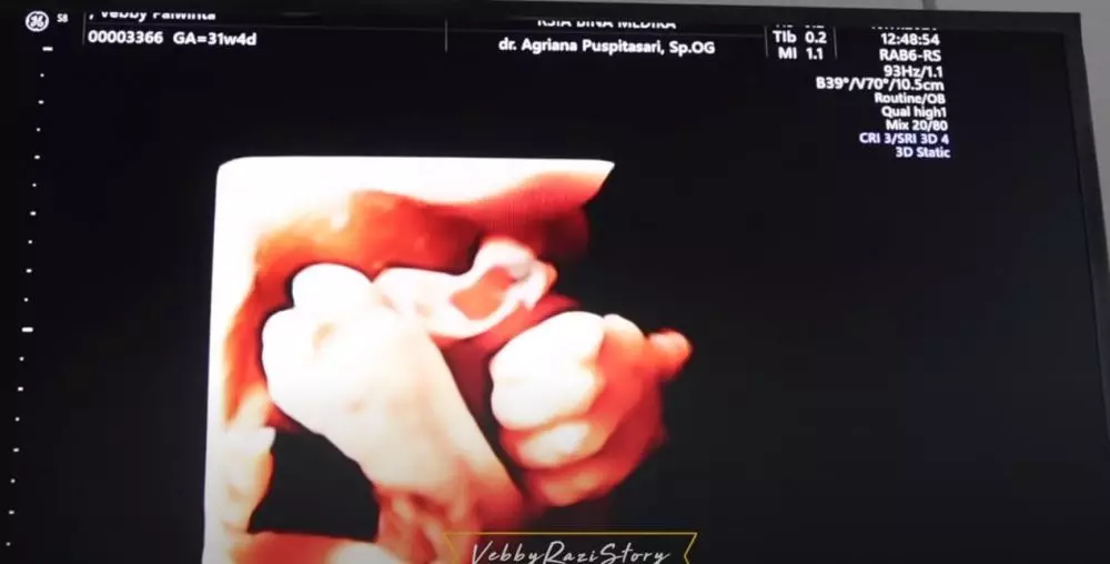 jenis kelamin anak Vebby Palwinta © 2020 brilio.net YouTube