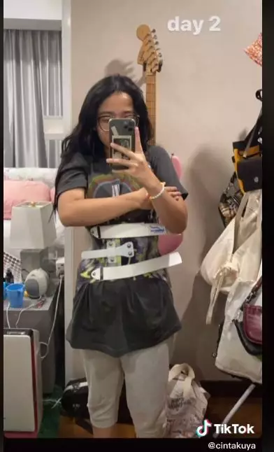 perjuangan cinta kuya hadapi skoliosis © TikTok