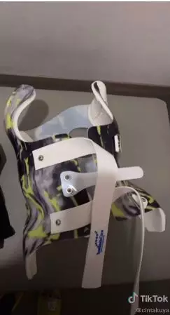 perjuangan cinta kuya hadapi skoliosis © TikTok