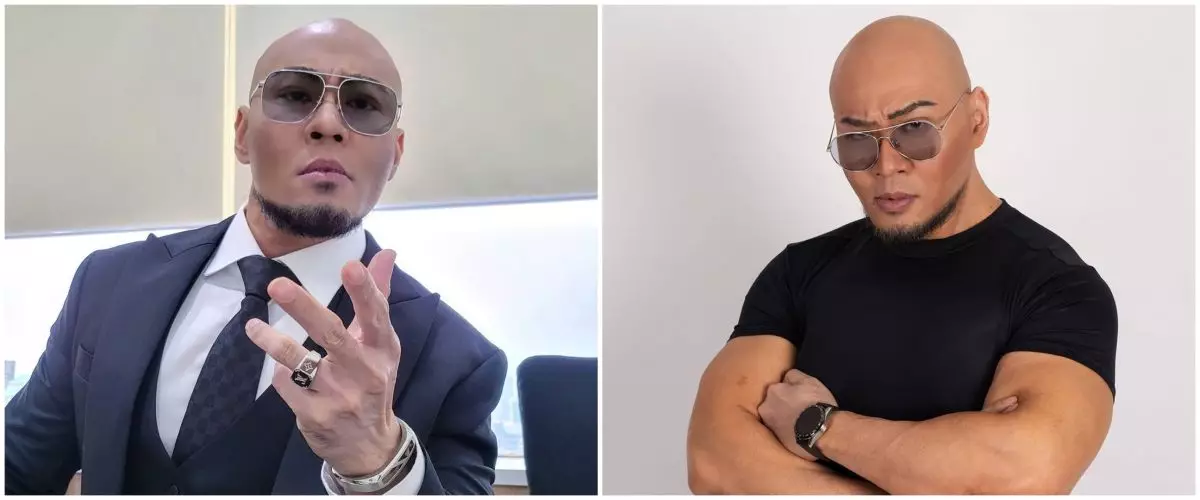 Tulang belakang rusak, kondisi Deddy Corbuzier buat dokter syok