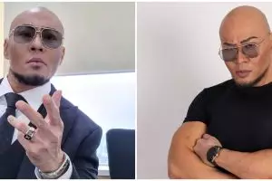 Tulang belakang rusak, kondisi Deddy Corbuzier buat dokter syok