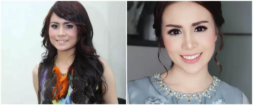 seleb yang hilangkan gingsulnya © 2020 brilio.net seleb yang hilangkan gingsulnya © 2020 brilio.net