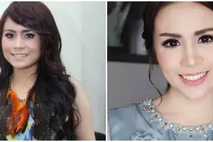 Potret dulu dan kini 5 seleb yang hilangkan gingsul