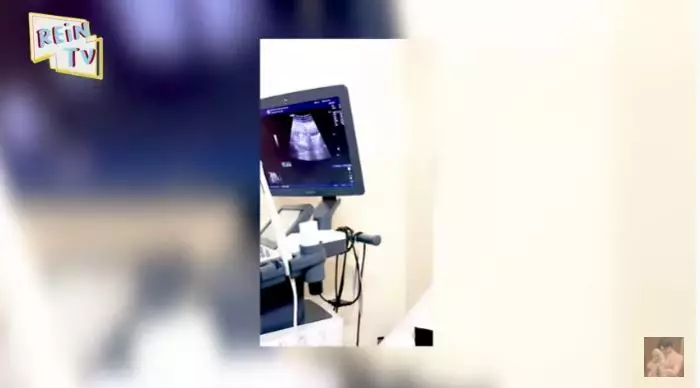 Dinda Hauw hamil ©Instagram