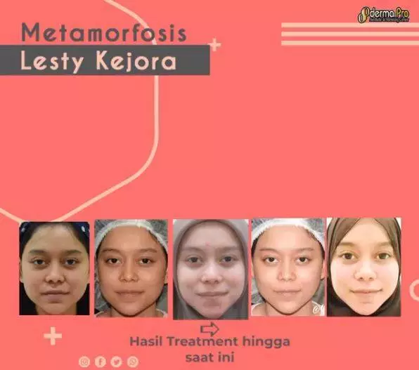 Transformasi Lesty Kejora saat awal karier © Instagram Transformasi Lesty Kejora saat awal karier © Instagram