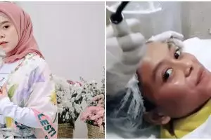 5 Momen Lesty Kejora perawatan kecantikan, botox hingga tanam benang