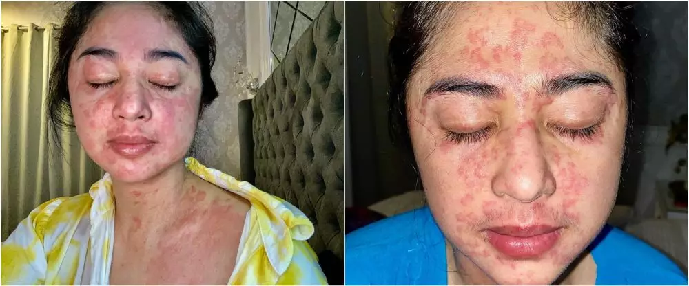 potret terbaru Dewi Perssik COVID-19 istimewa