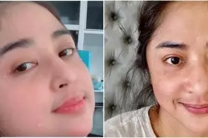 Potret terbaru Dewi Perssik sembuh dari Covid-19, alami gejala langka