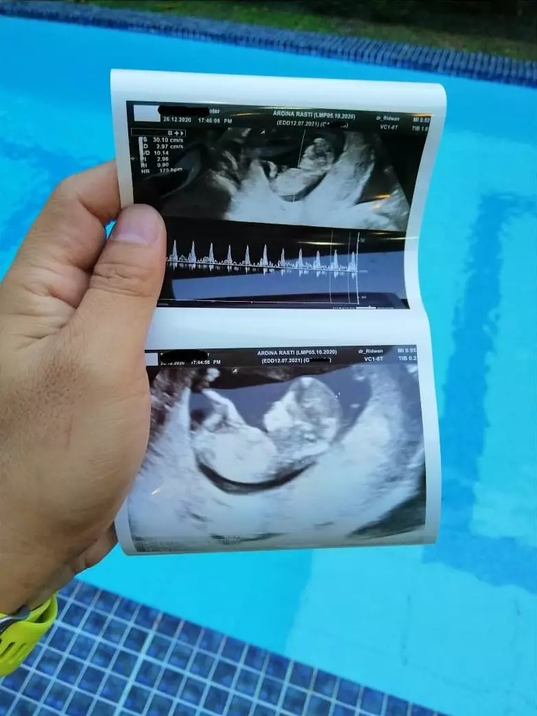 Ardina Rasti umumkan kehamilan kedua © 2020 brilio.net Ardina Rasti umumkan kehamilan kedua © 2020 brilio.net