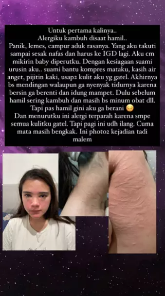  Alergi Audi Marissa Instagram