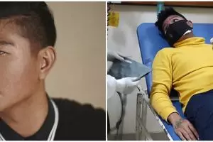 4 Fakta Andika eks Kangen Band positif Covid-19, alami sesak napas