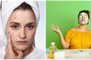 5 Cara membuat masker lidah buaya campur madu, aman dan mudah