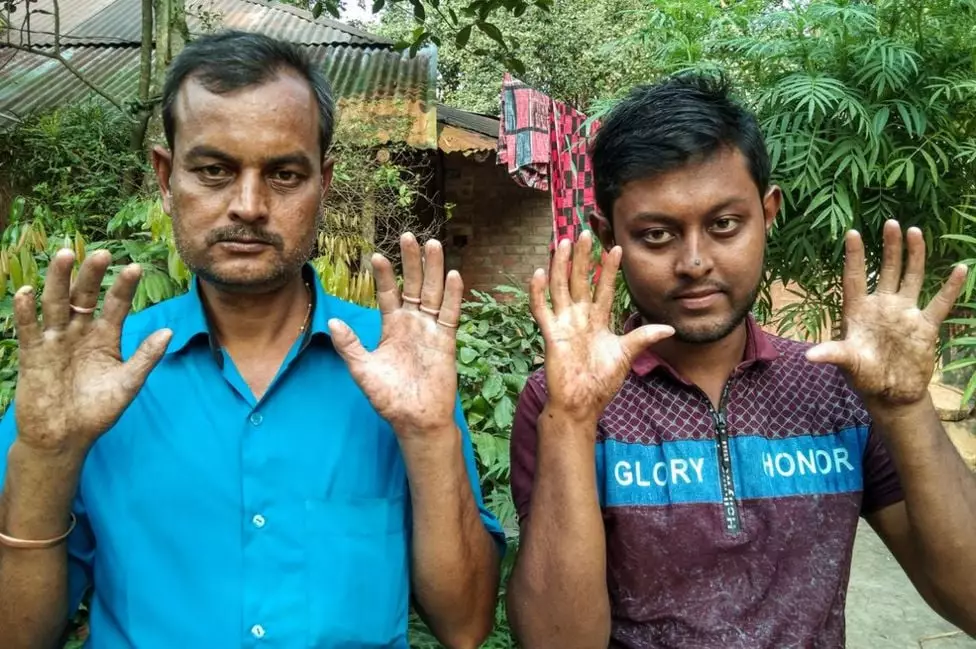 keluarga nggak punya sidik jari Berbagai sumber keluarga nggak punya sidik jari Berbagai sumber