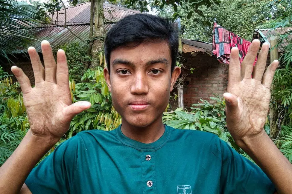 keluarga nggak punya sidik jari Berbagai sumber keluarga nggak punya sidik jari Berbagai sumber