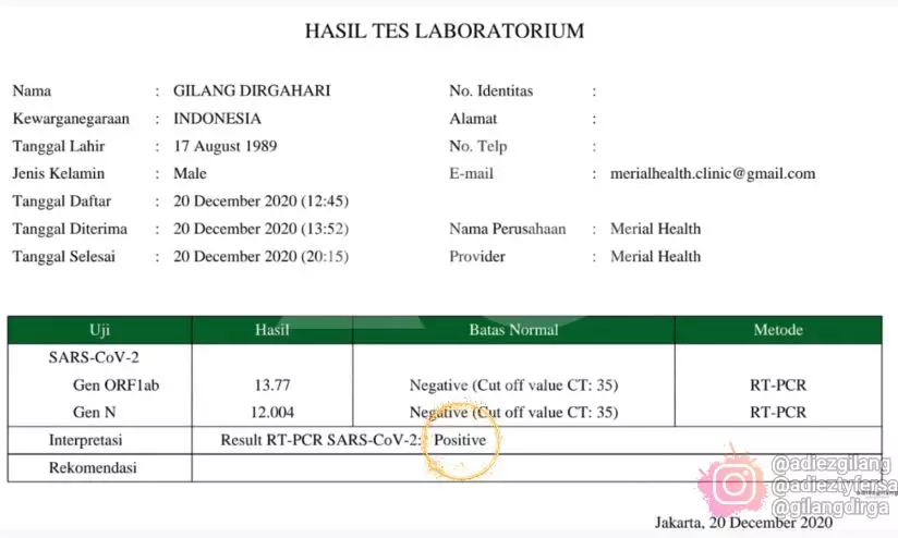 gilang dirga positif covid-19 © berbagai sumber